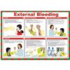 External Bleeding Safety Poster Laminated 590mm x 420mm thumbnail-0